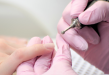 Fontos frézert használni az Unibrace körömszabályozás előtt?